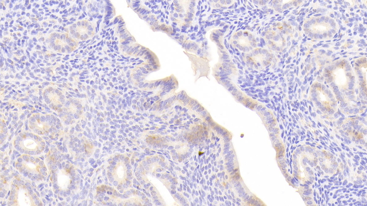 Polyclonal Antibody to Complement 1 Inhibitor (C1INH)