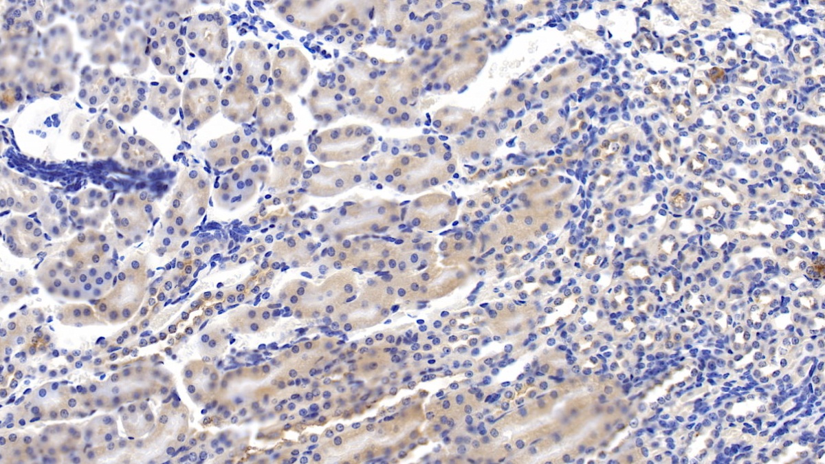 Polyclonal Antibody to Complement 1 Inhibitor (C1INH)