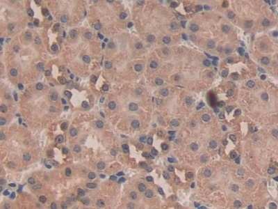 Polyclonal Antibody to Nesfatin 1 (NES1)