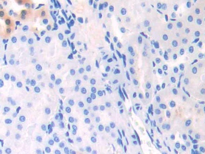 Polyclonal Antibody to Apolipoprotein C1 (APOC1)