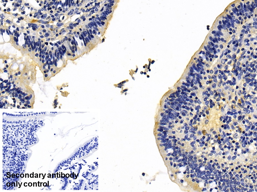 Polyclonal Antibody to Maltase-glucoamylase (MGAM)