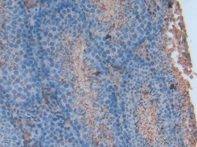 Polyclonal Antibody to Annexin V (ANXA5)