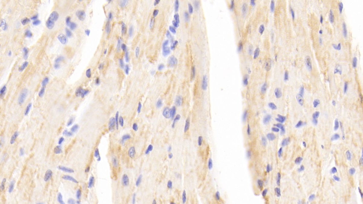 Polyclonal Antibody to Beta-2-Microglobulin (b2M)