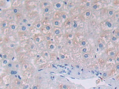 Polyclonal Antibody to Transferrin Receptor 2 (TFR2)