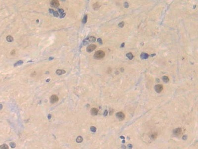 Polyclonal Antibody to Centromere Protein E (CENPE)