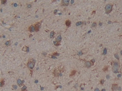 Polyclonal Antibody to Calnexin (CNX)