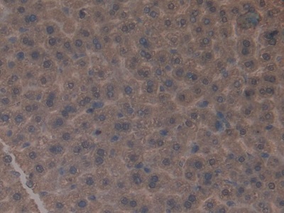 Polyclonal Antibody to Glutamate Dehydrogenase 1 (GLUD1)