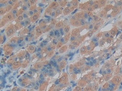 Polyclonal Antibody to Cathepsin L (CTSL)