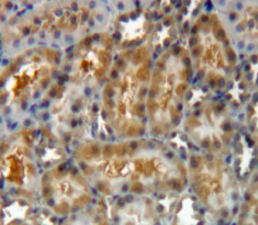 Polyclonal Antibody to Galectin 8 (GAL8)