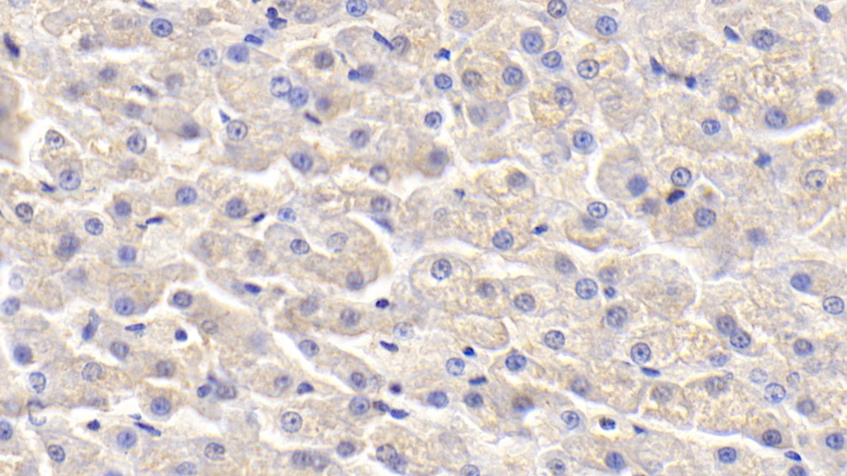 Polyclonal Antibody to Apolipoprotein H (APOH)