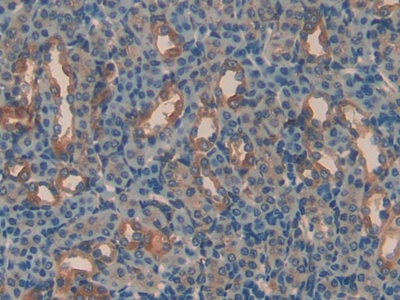 Polyclonal Antibody to Apolipoprotein H (APOH)