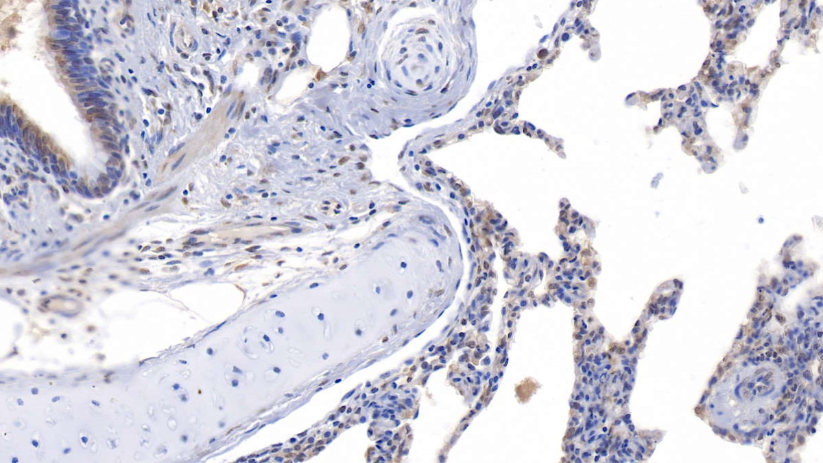 Polyclonal Antibody to Asprosin