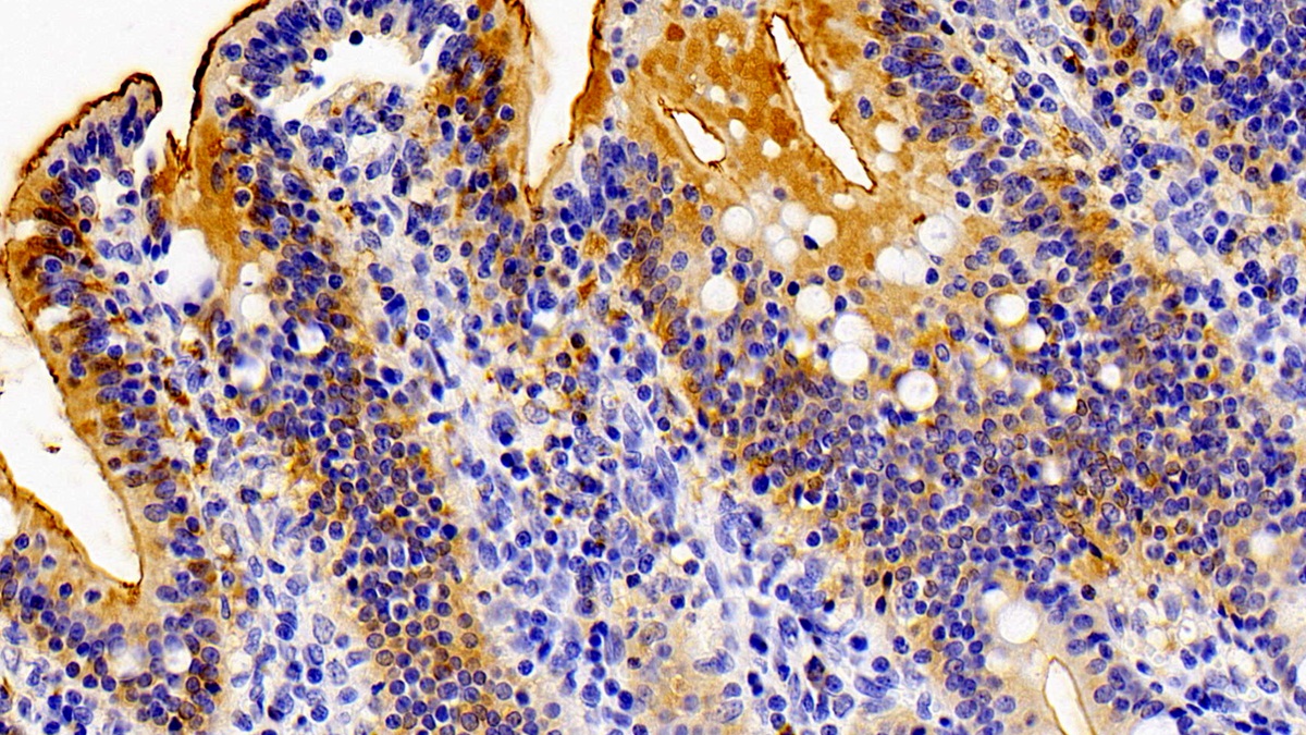 Polyclonal Antibody to Fatty Acid Binding Protein 6, Ileal (FABP6)