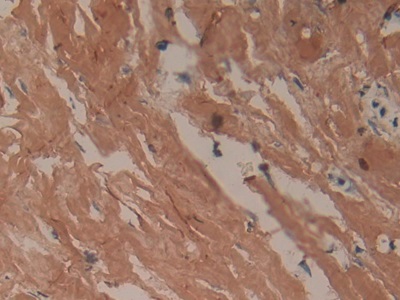 Polyclonal Antibody to Collagen Type I Alpha 1 (COL1a1)