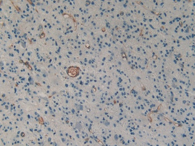 Polyclonal Antibody to Urotensin 2 (UST2)