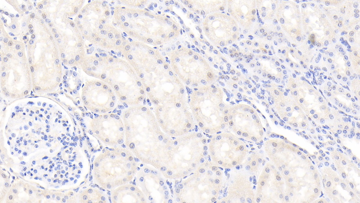 Polyclonal Antibody to Gelsolin (GSN)