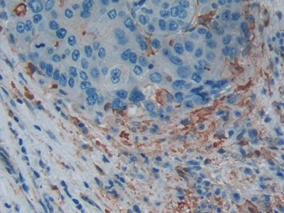 Polyclonal Antibody to Gelsolin (GSN)