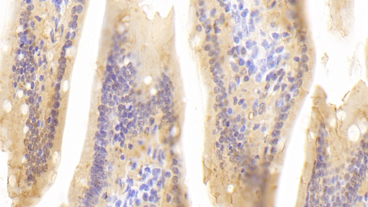 Polyclonal Antibody to Retinol Binding Protein 2, Cellular (RBP2)