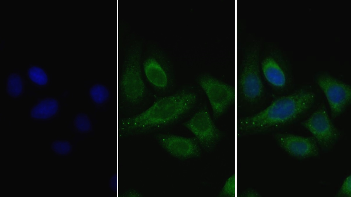 Polyclonal Antibody to Lipoprotein lipase (LPL)