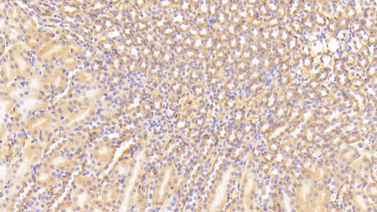 Polyclonal Antibody to Complement Component 3a (C3a)