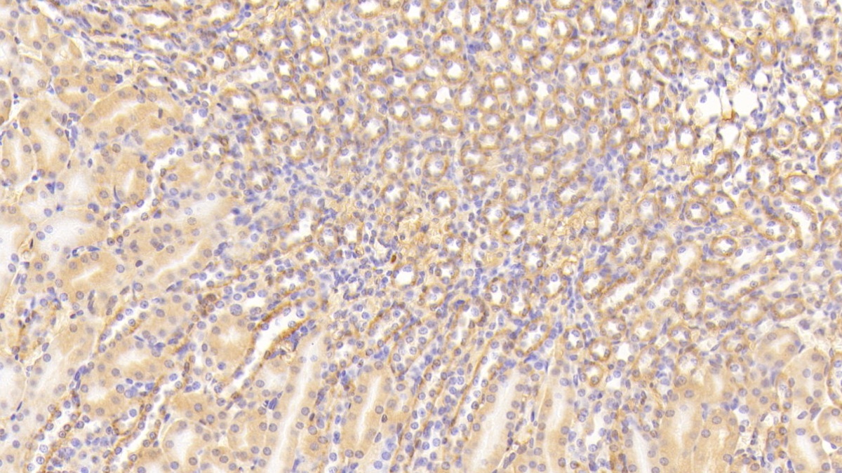 Polyclonal Antibody to Complement Component 3a (C3a)