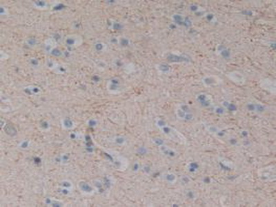 Polyclonal Antibody to Substance P (SP)