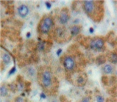 Polyclonal Antibody to Tissue Factor Pathway Inhibitor (TFPI)