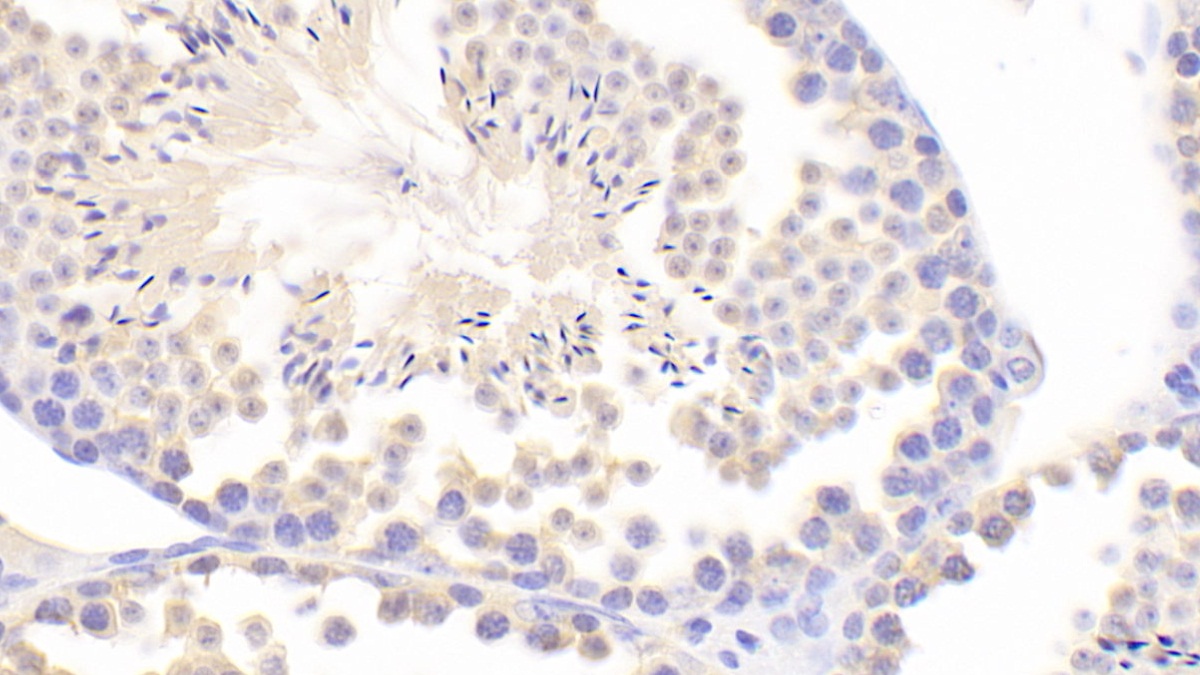 Polyclonal Antibody to Inhibin Alpha (INHa)