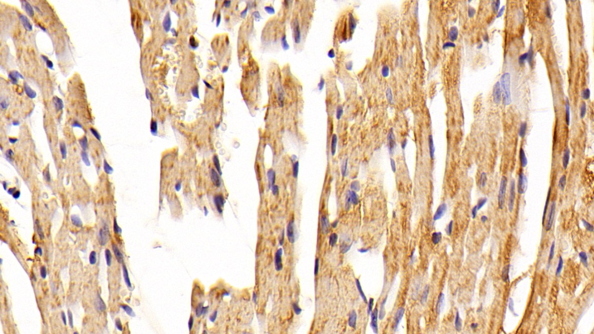 Polyclonal Antibody to Sex Hormone Binding Globulin (SHBG)