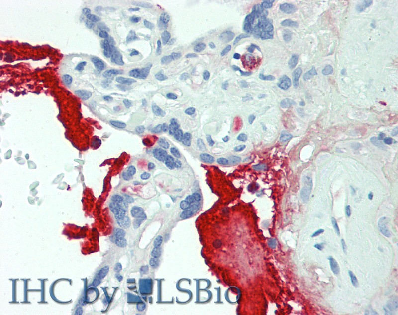 Polyclonal Antibody to Matrix Metalloproteinase 12 (MMP12)