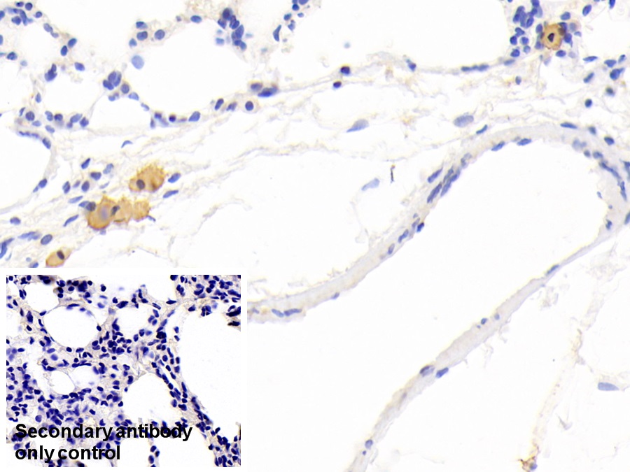 Polyclonal Antibody to Matrix Metalloproteinase 12 (MMP12)