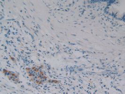 Polyclonal Antibody to Phospholipase A2, Calcium Independent (iPLA2)