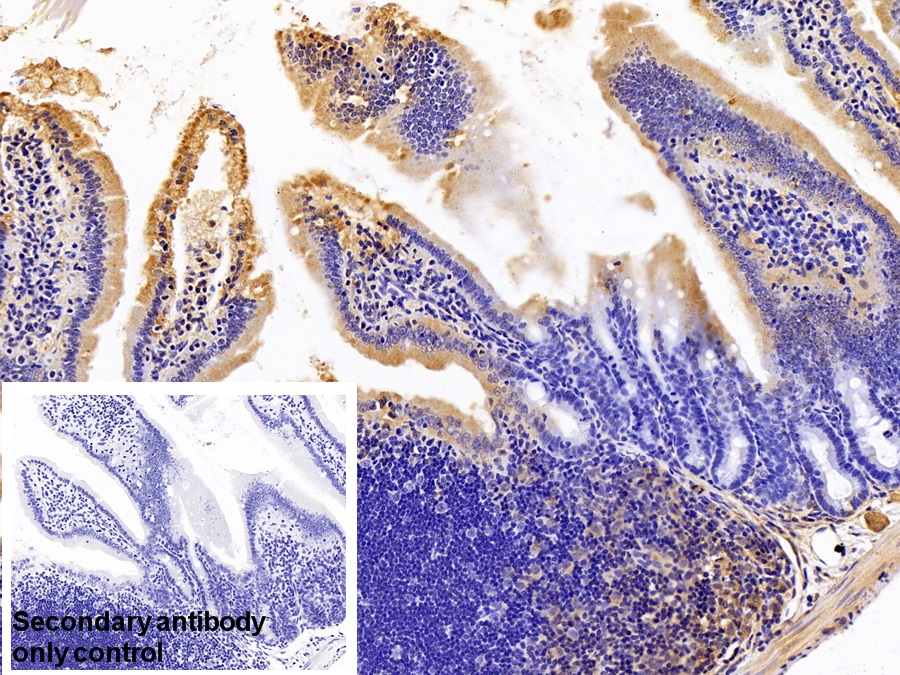 Polyclonal Antibody to Phospholipase A2, Calcium Independent (iPLA2)