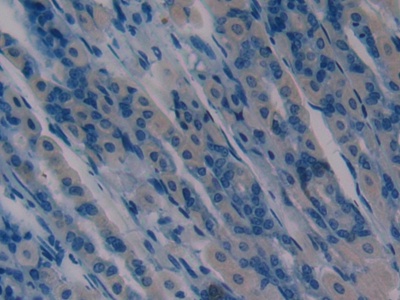 Polyclonal Antibody to Alpha-Hemoglobin Stabilizing Protein (aHSP)