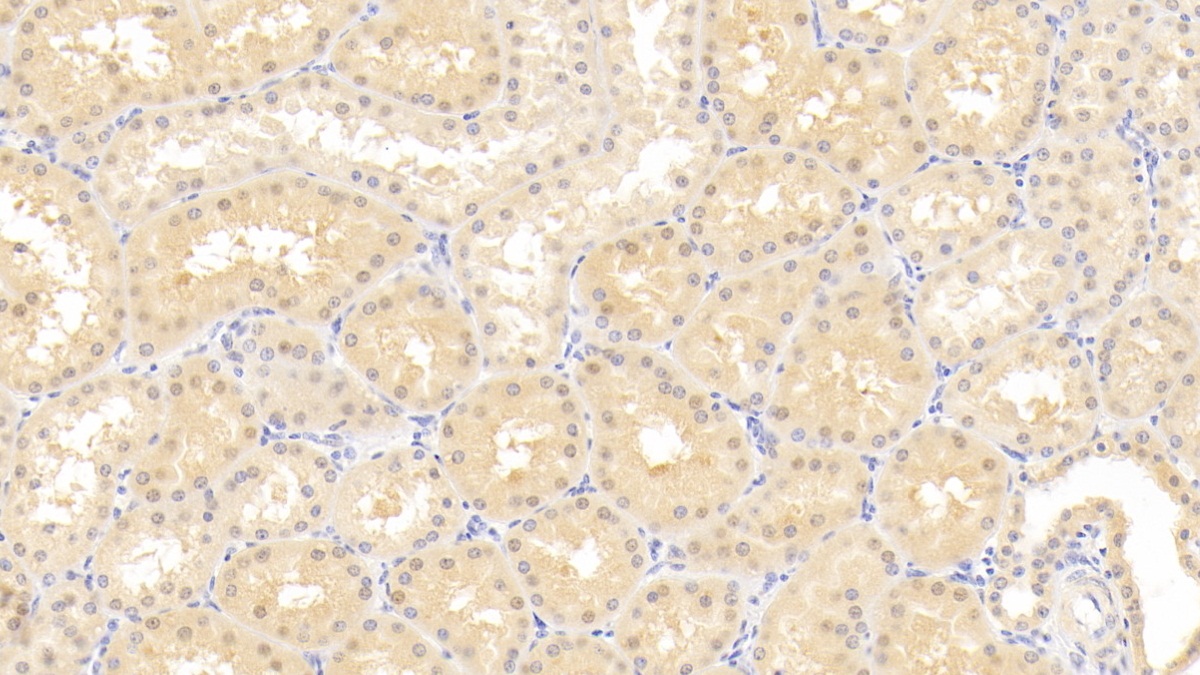 Polyclonal Antibody to Elastin Microfibril Interface Located Protein 1 (EMILIN1)