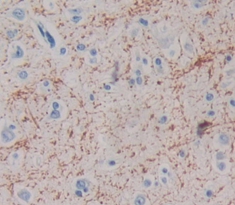 Polyclonal Antibody to Myelin Associated Glycoprotein (MAG)