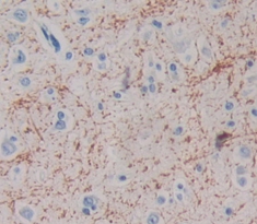 Polyclonal Antibody to Myelin Associated Glycoprotein (MAG)