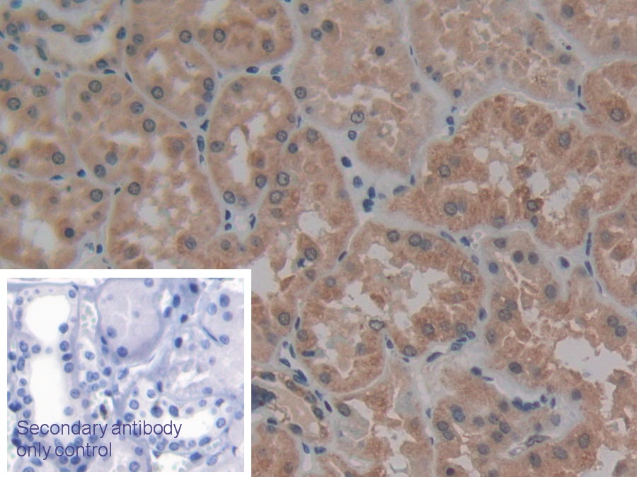 Polyclonal Antibody to Apoptosis Associated Tyrosine Kinase (AATK)