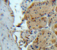 Polyclonal Antibody to Sirtuin 2 (SIRT2)