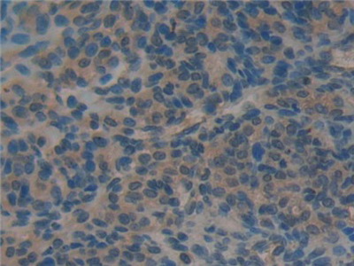 Polyclonal Antibody to Protein Kinase C Delta (PKCd)