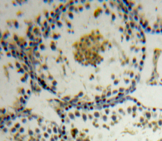 Polyclonal Antibody to Apoptosis Antagonizing Transcription Factor (AATF)