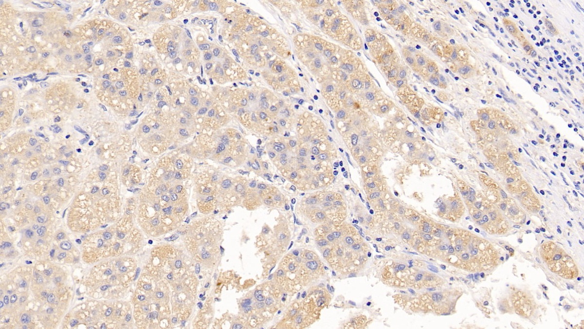 Polyclonal Antibody to Luteinizing Hormone (LH)