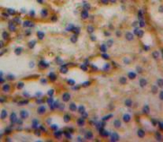 Polyclonal Antibody to Luteinizing Hormone (LH)