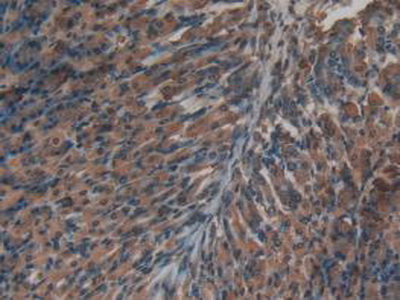 Polyclonal Antibody to Insulin (INS)