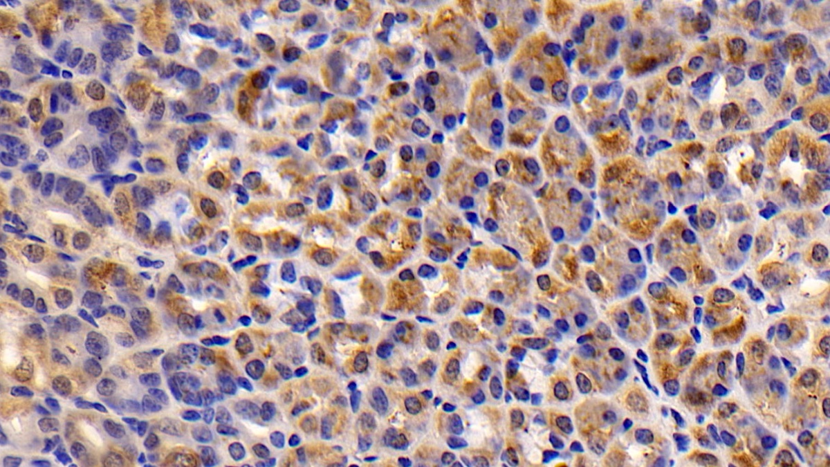 Polyclonal Antibody to Caspase 7 (CASP7)