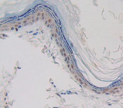 Polyclonal Antibody to Caspase 14 (CASP14)