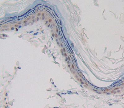 Polyclonal Antibody to Caspase 14 (CASP14)