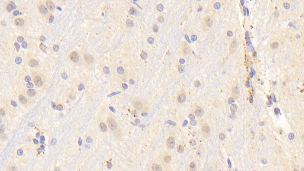 Polyclonal Antibody to Heat Shock Transcription Factor 2 (HSF2)