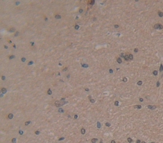 Polyclonal Antibody to Osteocalcin (OC)