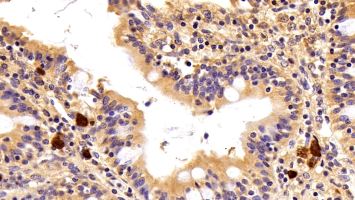 Polyclonal Antibody to Cystatin A (CSTA)